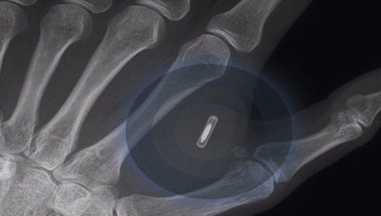 Svezia, in futuro chip nella mano per pagare metro e tram